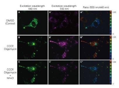 mitophagy.jpg