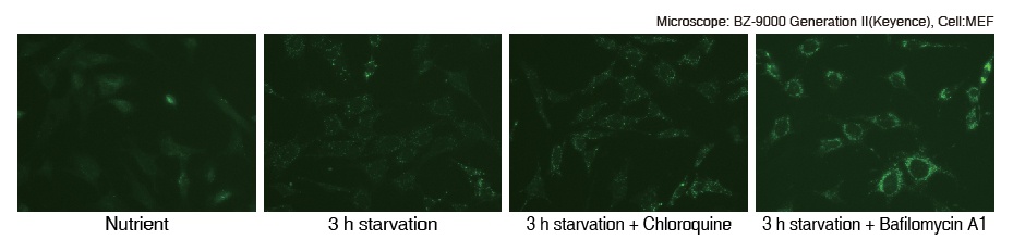 autophagy_watch_IC