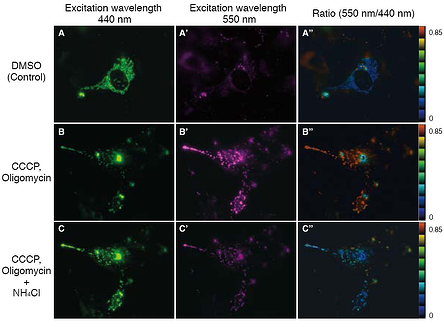 mitophagy_visualized